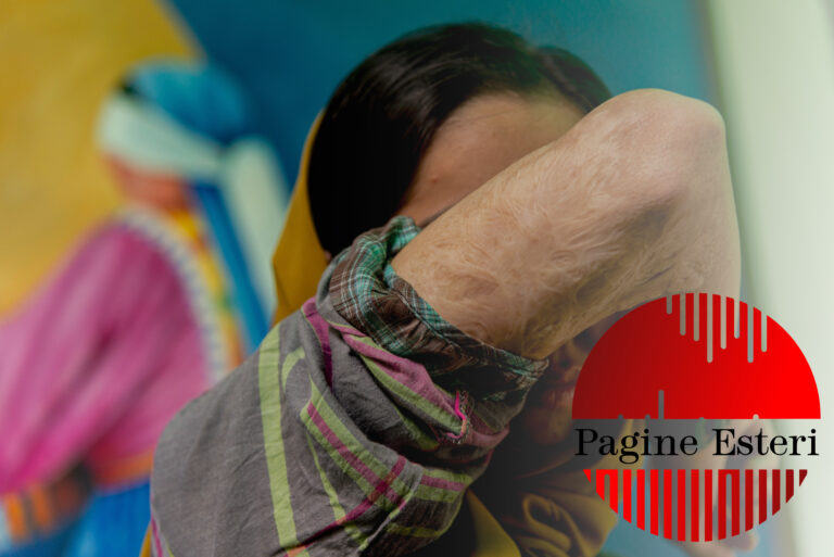 Paksima 15 anni rifugiata in Pakistan mostra le sue cicatrici delle torture subite dai Talebani dopo la presa di Kabul.